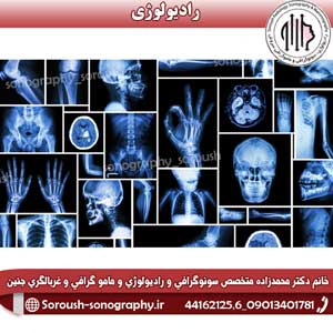 رادیولوژی