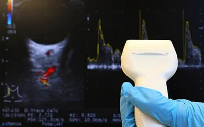 سونوگرافی داپلر