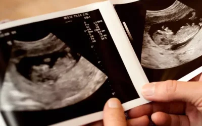 آیا ممکن است سونوگرافی در تشخیص جنسیت نوزاد اشتباه کند؟
