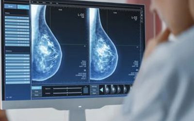 سونوگرافی سینه یا ماموگرافی کدام بهتر است ؟