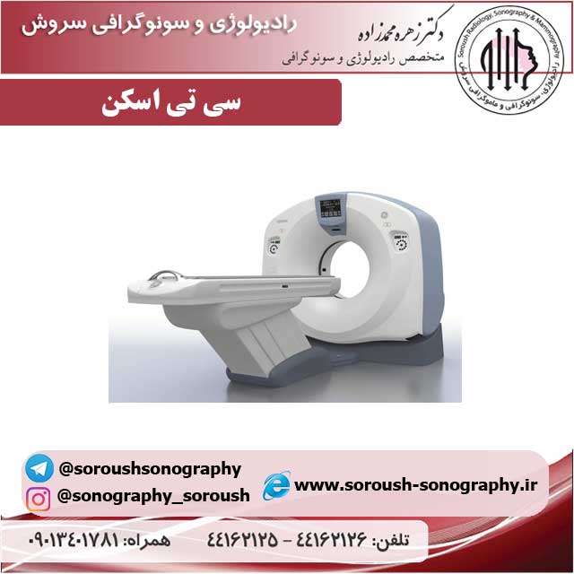 سی تی اسکن