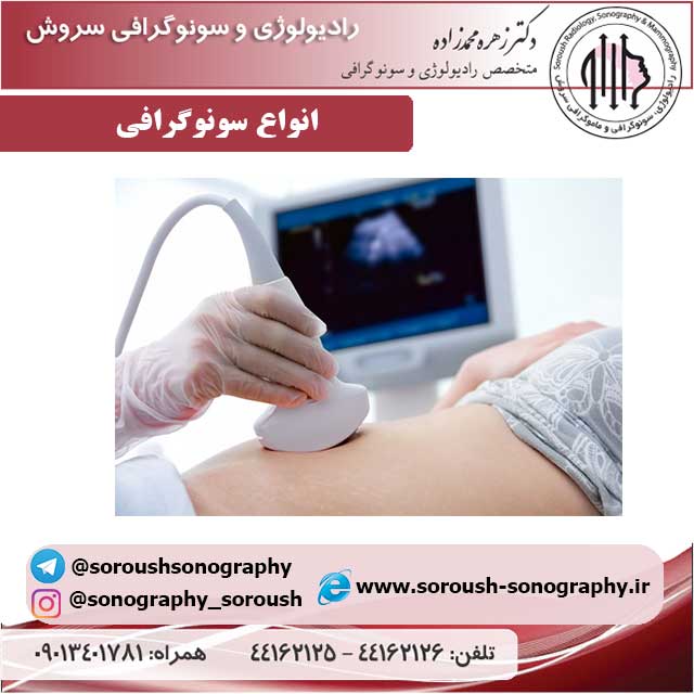 انواع سونوگرافی