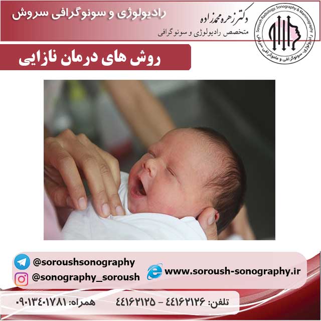 روش های درمان نازایی