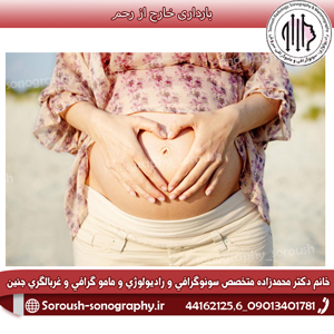 بارداری خارج از رحم