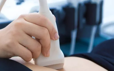 صفر تا صد سونوگرافی های دوران باداری