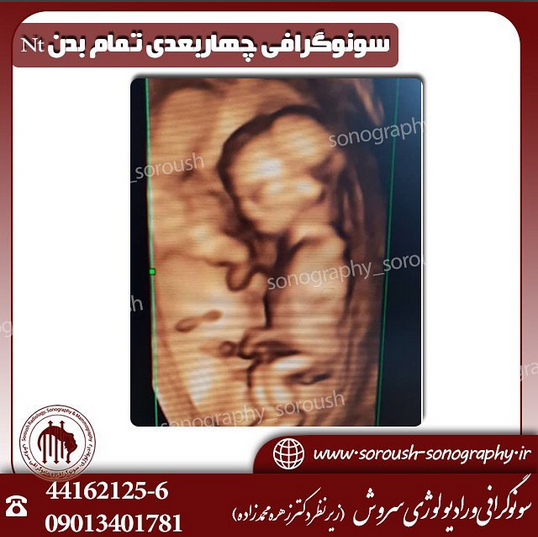 تفاوت سونوگرافی سه بعدی و چهار بعدی