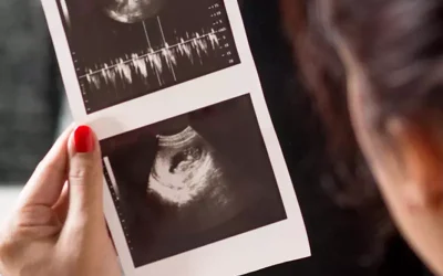 سونوگرافی تعیین جنسیت در هفته چندم بارداری انجام می شود و چقدر خطا دارد؟