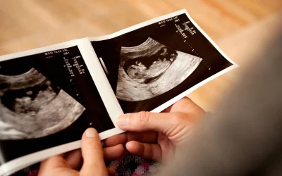 سونوگرافی جهت تعیین جنسیت جنین
