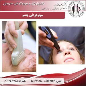 سونوگرافی چشم در بهترین مرکز سونوگرافی تهران