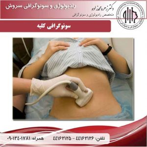 سونوگرافی کلیه در بهترین مرکز سونوگرافی تهران