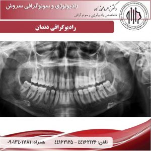 رادیولوژی دندان در بهترین مرکز سونوگرافی
